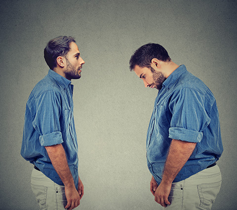 Hombre que debe practicarse liposuccin en Bogot